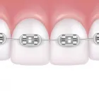 La imagen 4 de la Empresa CLÍNICA ODONTÓLOGICA DENTOIMAGEN Odontología en Buga VAC
