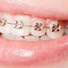 La imagen 2 de la Empresa DENTA CLÍNICA ODONTOLÓGICA Urgencias en Barranquilla ATL