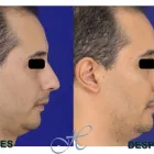 La imagen 2 de la Empresa DR JORGE ALIRIO HOLGUÍN RUIZ Otorrinolaringología en Cali VAC