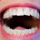 La imagen 3 de la Empresa JAIME ALBERTO VARGAS V. CIRUJANO ORAL-ESTOMATÓLOGO Odontología en Medellín ANT