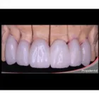La imagen 5 de la Empresa LABORATORIO DENTAL LAGOS 2 Tienda de suministros médicos en Bucaramanga SAN