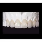 La imagen 6 de la Empresa LABORATORIO DENTAL LAGOS 2 Tienda de suministros médicos en Bucaramanga SAN