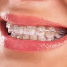 La imagen 2 de la Empresa LUISA EUGENIA QUINTERO DUQUE - ODONTÓLOGOS REHABILITACIÓN ORAL Odontología en Manizales CAL