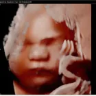 La imagen 6 de la Empresa MEDIFEM Radiografía y diagnóstico por imagen en Ibagué TOL