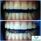La imagen 4 de la Empresa ORALSALUD ODONTOLOGÍA INTEGRAL Odontología cosmética en Copacabana ANT
