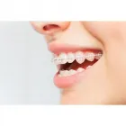 La imagen 2 de la Empresa RUBÉN DARIO MENGUAL PÉREZ Periodoncista de implantes dentales en Ibagué TOL
