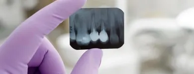 La imagen 2 de la Empresa CENTRO DE RADIOLOGÍA ORAL DIGITAL CERO Radiología en Buga VAC