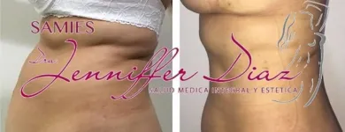 La imagen 1 de la Empresa IPS SAMIES DRA. JENNIFFER DÍAZ Odontología en Barranquilla ATL