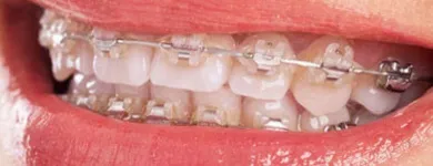 La imagen 2 de la Empresa LUISA EUGENIA QUINTERO DUQUE - ODONTÓLOGOS REHABILITACIÓN ORAL Odontología en Manizales CAL