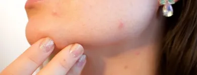 La imagen 3 de la Empresa LUZ MARINA GÓMEZ VARGAS - DERMATÓLOGA Médico en Medellín ANT