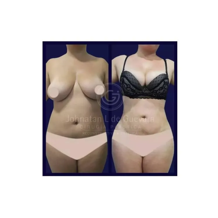 La imagen 1 de la Empresa DR. GUEVARA | CIRUGÍA PLÁSTICA | MAMOPLASTIA, RINOPLASTIA,
