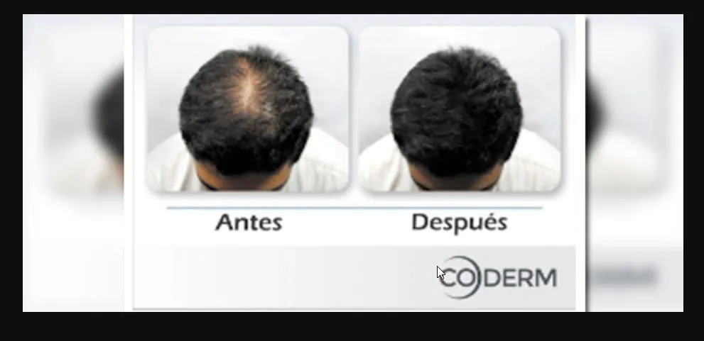La imagen 2 de la Empresa DR. GENER ALEJANDRO MANCILLA DÍAZ